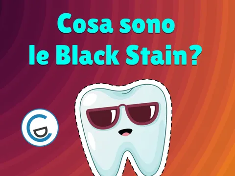 Poster video Cosa sono le Black Stain, macchioline scure nella bocca dei più piccoli