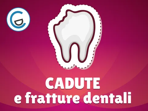 Poster video Cadute e fratture dentali. Che fare?
